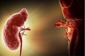 Dr. Madhukar Gupta - Kidney Transplant Specialist in Agra